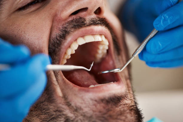 Best Dentist for Tooth Abscess  in Harrodsburg, KY