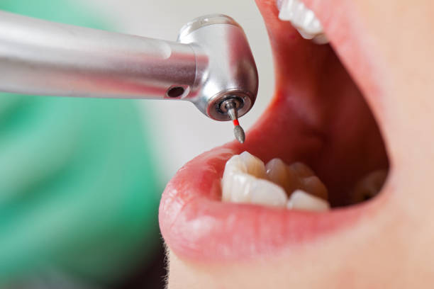 Best Root Canal Emergency Dentist  in Harrodsburg, KY